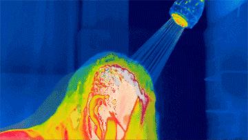 头皮屑多的解决方法小妙招,头皮屑突然增多的原因和解决方法