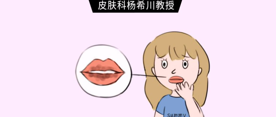 口腔里和嘴唇长满了黑点,口唇上的黑斑要引起重视