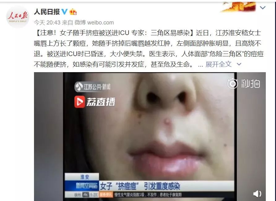 这个地方长痘千万别动!这起悲剧为所有人敲响警钟!