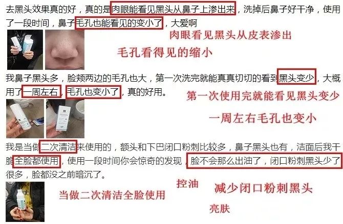 拨黑头工具草莓鼻,去黑头神器真的能吸出黑头