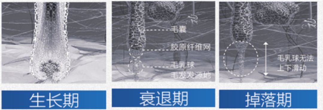 拯救秃头黑科技,秃头女孩最快的拯救办法是什么