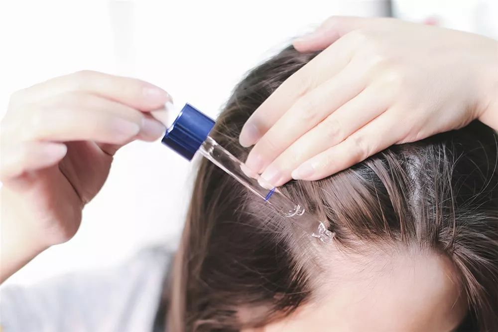 拯救秃头黑科技,秃头女孩最快的拯救办法是什么