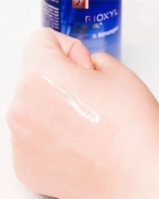 拯救秃头黑科技,秃头女孩最快的拯救办法是什么