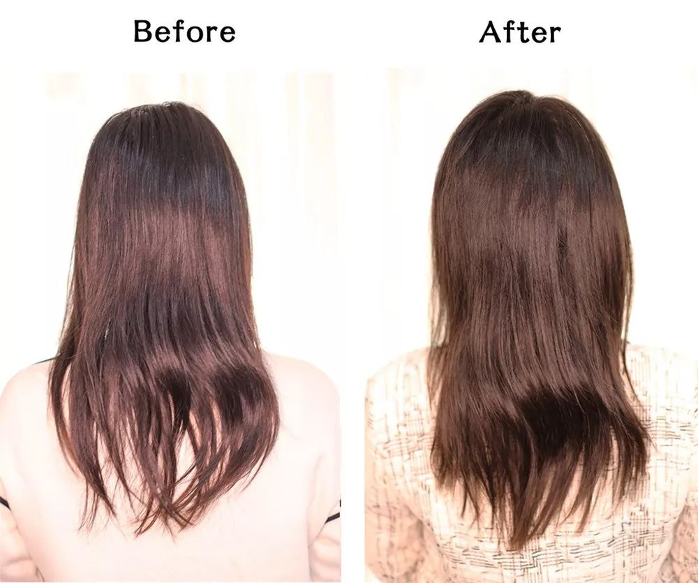 拯救秃头黑科技,秃头女孩最快的拯救办法是什么