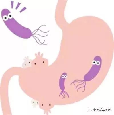 一人感染幽门螺杆菌一家都有吗,全家都感染幽门螺旋杆菌怎么治疗