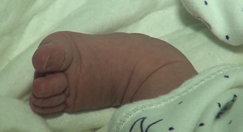 事发常州:女婴出生无肛门,急需治疗费用!