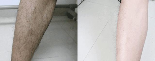 ⊙超管用！不用刮、零疼痛，轻轻一抹就能「快速脱毛」