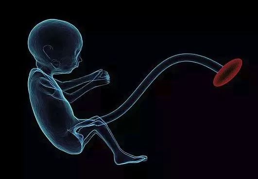 产科争议问题|椎管内分娩镇痛是否会延长产程？对胎儿有什么影响？