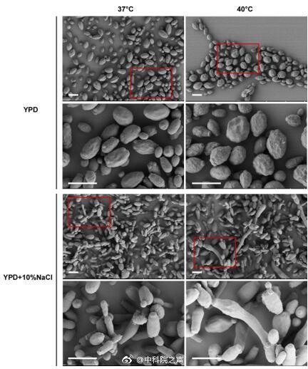 美国多地爆发致命真菌,中国已感染的超级真菌