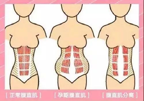 产妇过了42天还需注意些什么,产后42天恶露不净怎么办