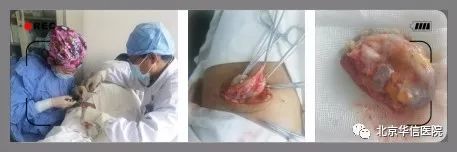 皮下囊实性肿瘤,皮下囊性肿物