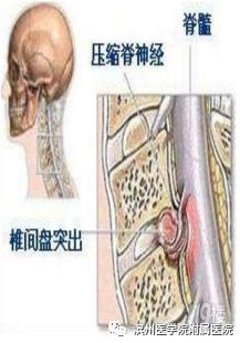 立竿见影运用什么原理,立竿见影实践