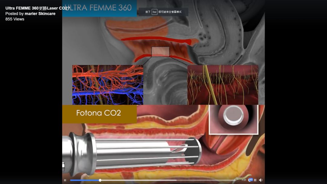 二胎后对老大的关爱应该怎样,二胎家庭其实更注重大宝的关心