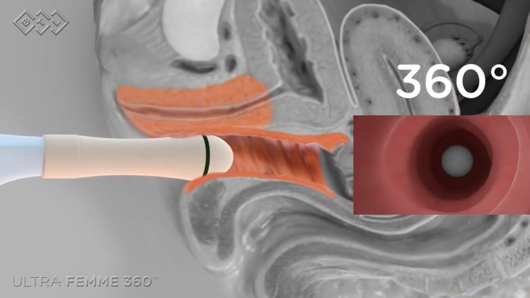 二胎后对老大的关爱应该怎样,二胎家庭其实更注重大宝的关心