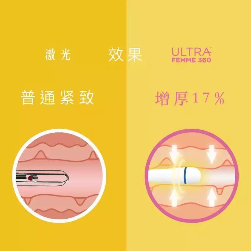 二胎后对老大的关爱应该怎样,二胎家庭其实更注重大宝的关心