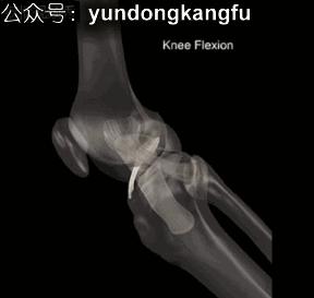 膝内侧副韧带损伤吃什么药,膝韧带损伤预防与康复训练