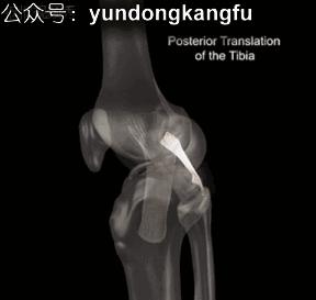 膝内侧副韧带损伤吃什么药,膝韧带损伤预防与康复训练