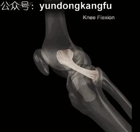 膝内侧副韧带损伤吃什么药,膝韧带损伤预防与康复训练