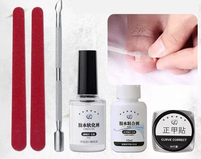 小脚趾甲长在肉里一碰就疼怎么办,指甲扎到肉里怎么处理