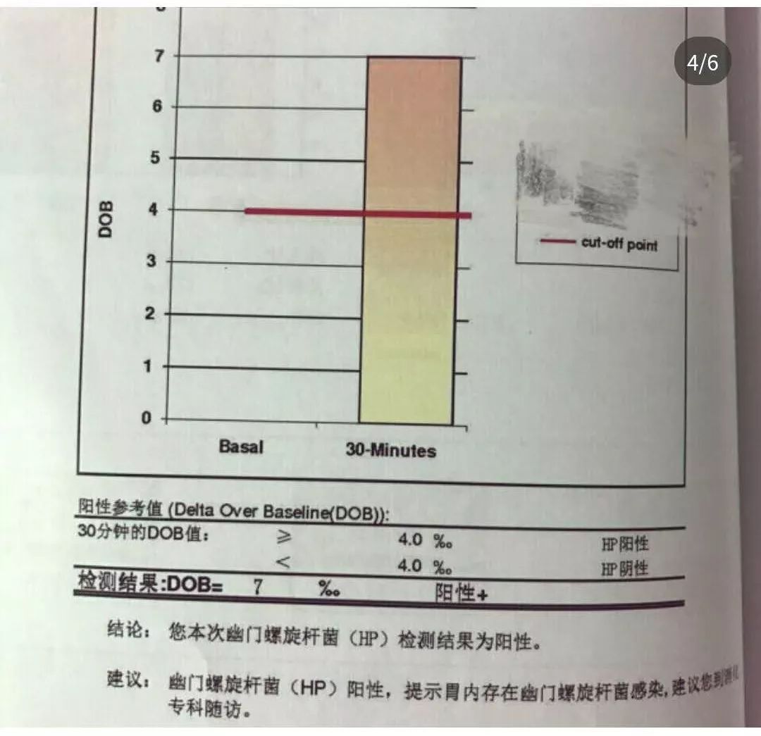 幽门螺旋杆菌的天敌克星,幽门螺旋杆菌的克星终于找到了