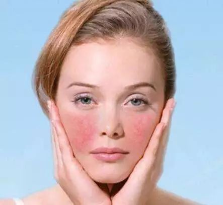 冬季皮肤瘙痒越抓越痒怎么用药,皮肤瘙痒是什么情况如何快速止痒