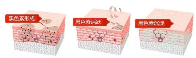 常见的美容激光项目,脉冲激光治疗后的注意事项