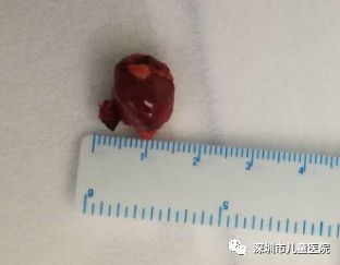 六岁的她每天都用“姨妈巾”，罪魁祸首是……家长注意，这怪病“偏爱”女孩