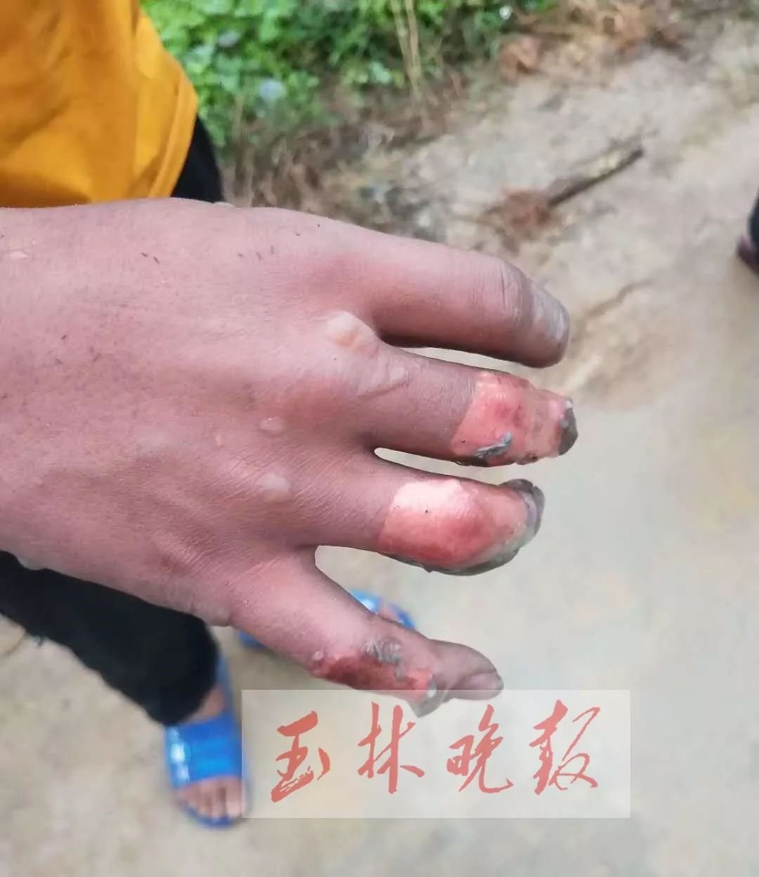 惊险瞬间男子在修手机时发生爆炸,一个小男孩玩手机爆炸搞笑视频