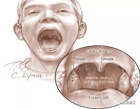 倪海厦说早上刷牙恶心干呕,倪海厦早上口干吐口水带血