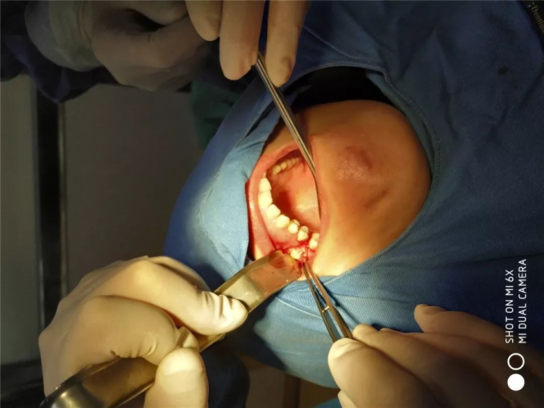 口腔种植零基础培训实操,口腔种植手术课程