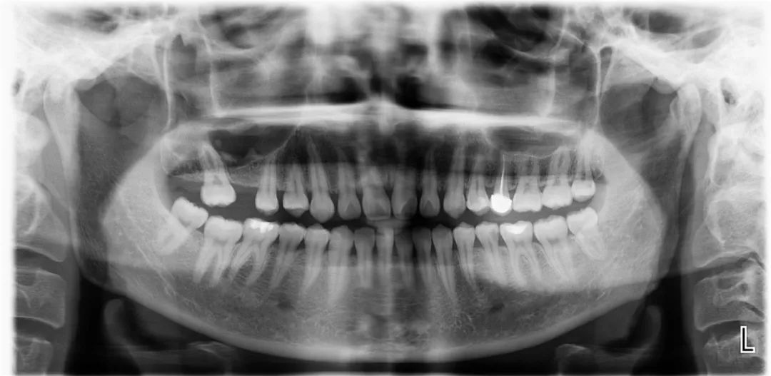 口腔种植零基础培训实操,口腔种植手术课程
