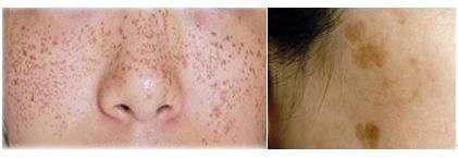 发了一张自拍给男朋友,给相亲对象发照片要不要开美颜