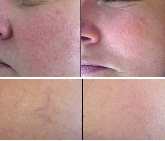 发了一张自拍给男朋友,给相亲对象发照片要不要开美颜