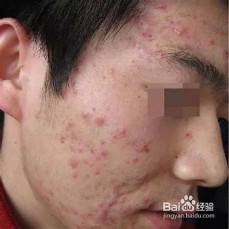 发了一张自拍给男朋友,给相亲对象发照片要不要开美颜