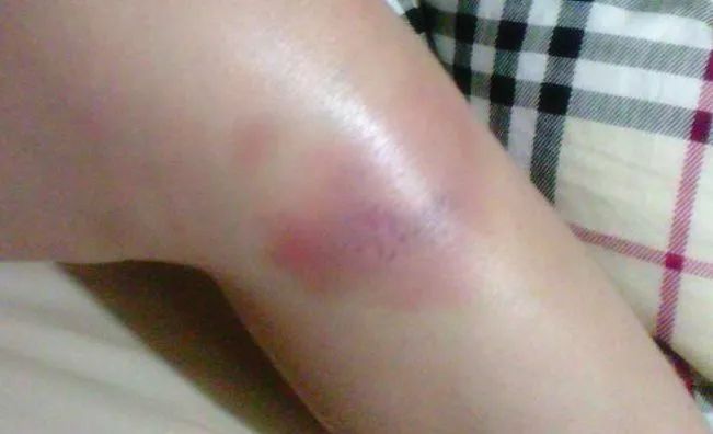 千里追风膏有什么用,本土千里追风膏