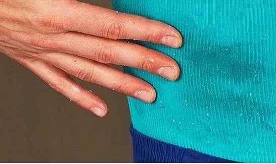 衣服发黄别扔了可以这样洗,衣服发黄用漂白剂能洗掉吗