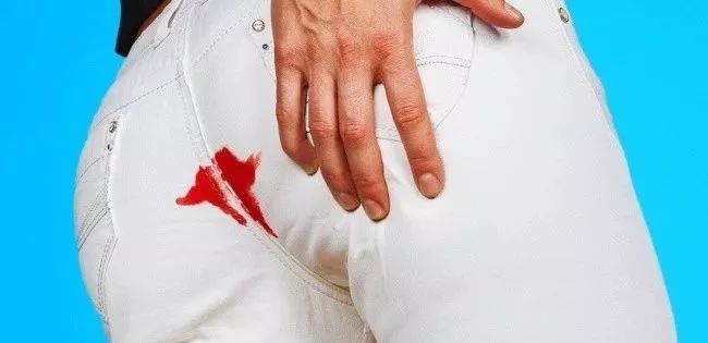 衣服发黄别扔了可以这样洗,衣服发黄用漂白剂能洗掉吗