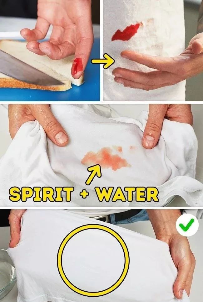 衣服发黄别扔了可以这样洗,衣服发黄用漂白剂能洗掉吗