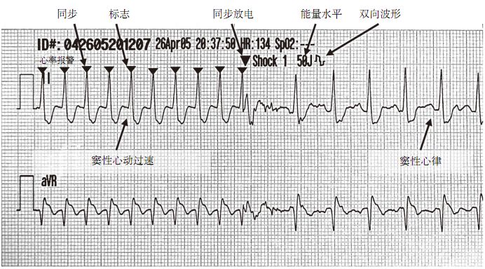 心动过速常见疾病的巧妙记忆,心动过速的病理原因分析