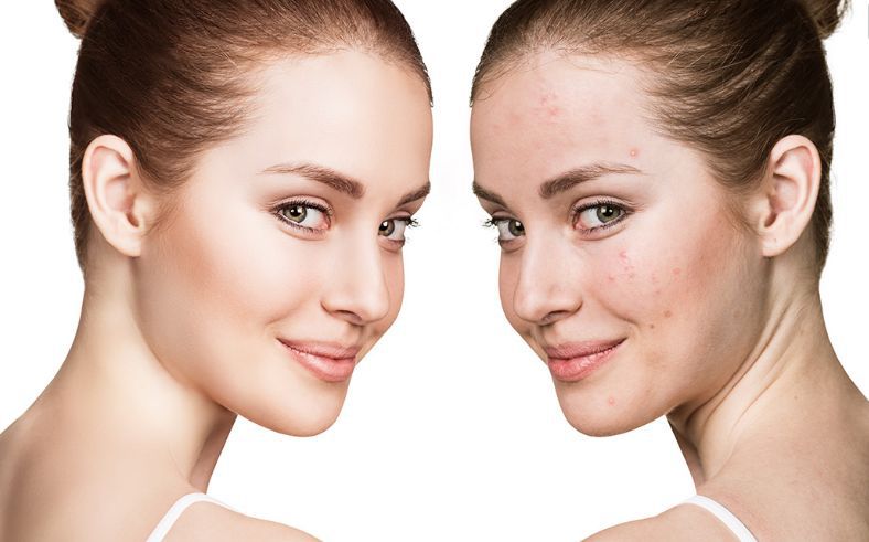 美肌工坊包头百货大楼钢铁大街店,59.9元抢美肤套餐4选3