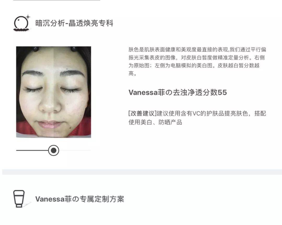 灏忚寕鑲岃瘖瀹ゅ埌搴曟湁澶氬己,灏忚寕鑲岃瘖瀹よˉ姘村悧