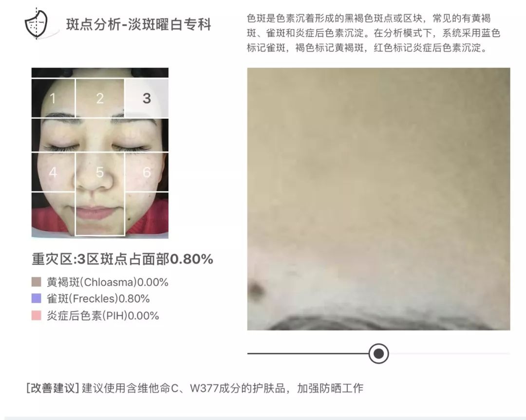 灏忚寕鑲岃瘖瀹ゅ埌搴曟湁澶氬己,灏忚寕鑲岃瘖瀹よˉ姘村悧