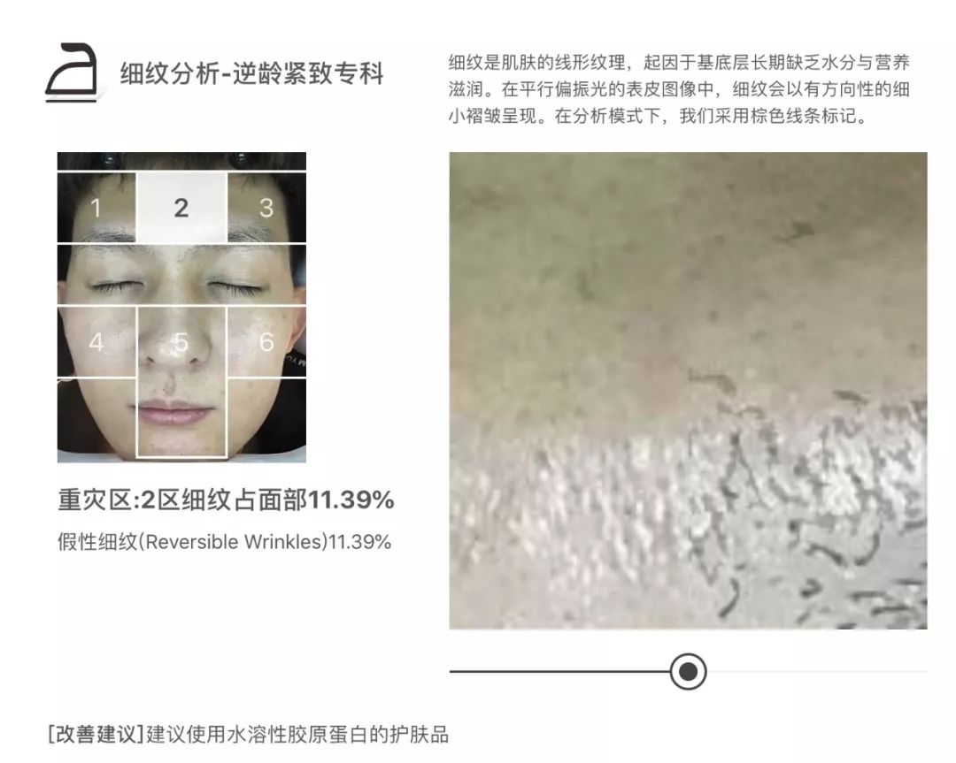 灏忚寕鑲岃瘖瀹ゅ埌搴曟湁澶氬己,灏忚寕鑲岃瘖瀹よˉ姘村悧