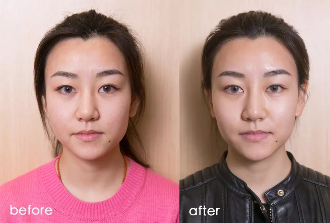 灏忚寕鑲岃瘖瀹ゅ埌搴曟湁澶氬己,灏忚寕鑲岃瘖瀹よˉ姘村悧