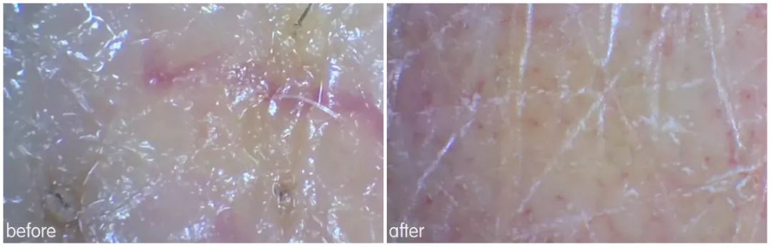 灏忚寕鑲岃瘖瀹ゅ埌搴曟湁澶氬己,灏忚寕鑲岃瘖瀹よˉ姘村悧