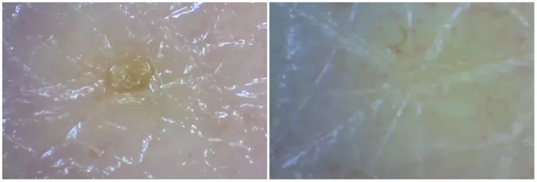 灏忚寕鑲岃瘖瀹ゅ埌搴曟湁澶氬己,灏忚寕鑲岃瘖瀹よˉ姘村悧