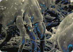 女性的妇科疾病70%和卫生巾有关,80%的女性都有妇科炎症对吗