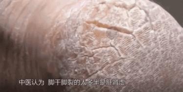 足部护理加长加热脚套,足部护理脚趾套品牌