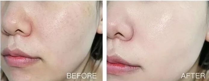 农科院面膜,农科院研发的面膜