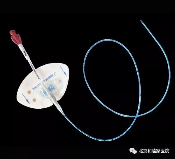 关于picc的简报,关于picc的故事